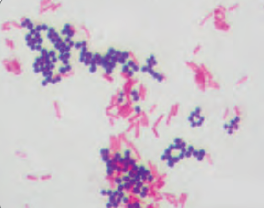 Görsel 3.17 Gram boyanma özelliklerine göre bakteriler. Mor renkte olanları gram (+), kırmızı renkte olanları gram (–) bakterilerdir.